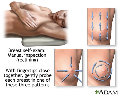 breast cancer screening.jpg